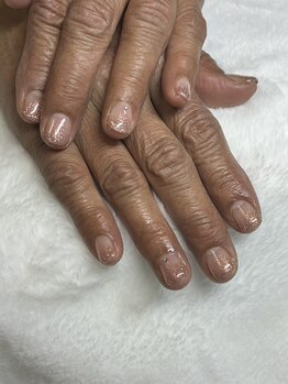 オランダエステティック(Holland Esthetics)/グラデーション