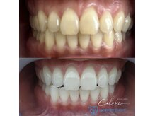 クロレ(Colorer)の雰囲気（医療機関と提携セルフホワイトニング！初回カウンセリング無料♪）