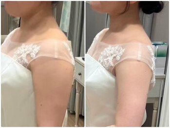 トレゾール(tresor)/★ブライダル★赤坂痩身エステ