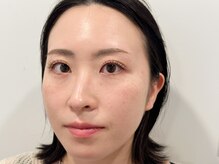 トミー(Tommy)/まつげパーマ