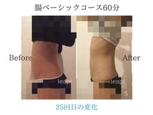 リープル(Leapl)/【腸もみ】腸もみ後の変化写真