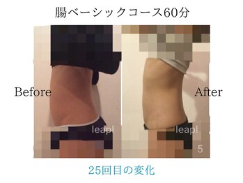 リープル(Leapl)/【腸もみ】腸もみ後の変化写真