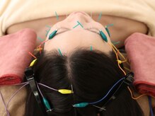 美鍼堂の雰囲気（信頼と実績の妊活鍼灸院■本格東洋医学の体質ケアを。）