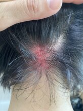 コル コルエ(koru korue)/脳に酸素が行かなくなります