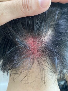 コル コルエ(koru korue)/脳に酸素が行かなくなります