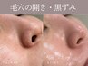 【毛穴改善】むきたてツヤ肌に☆剥離無ハーブピーリング＋デコルテマッサージ