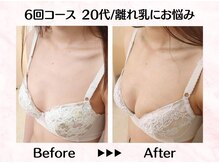 美人バスト リグラス(ReGrous)/バストアップbefore,after
