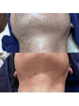 ブリリア(Brillia)/白ヒゲ、完全卒業