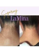 ラ ミーナ(LaMina)/うなじシュガーリング