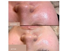 ラヴィンの雰囲気(韓国美肌wax♪角質、産毛除去ターンオーバー整い☆ツヤ肌即実感)