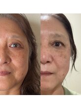 ヴェレン(Wellen)/ビフォーアフター