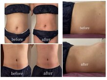 寝ながら芯から温まり、巡りが整ってボディラインスッキリ！