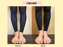 長年のお悩みも根本改善！