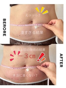 リラクゼーションサロン エステ日和/50代☆1回の結果です♪