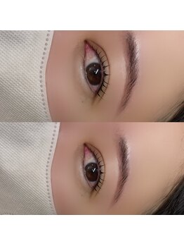 アンドユー(and.U)/