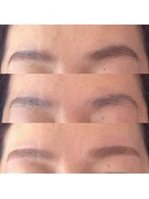 ニニ(Nini)/左右差が気になる方へ