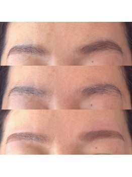 ニニ(Nini)/左右差が気になる方へ