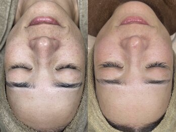 ベル(Belle)の写真/疲れ顔を鏡で見るたびに、気分が落ちちゃうアナタに。お肌もワントーンあがることで、気持ちも明るくなる♪