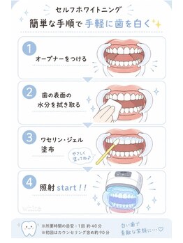 ホワイト 上乃木南店(WHITE)/照射までの流れ