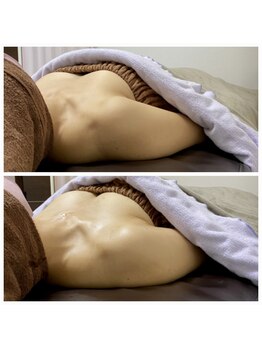 ティアラ(Tiara)/バストの大きさが気になる方に◎