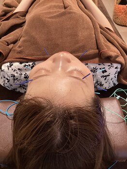 ハリファ鍼灸院 横浜関内院(HariFa鍼灸院)/美容施術/美容鍼