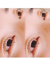 コア(Koa)/パリジェンヌリフト