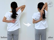 エーアール(AR)/【Before/After】5回目