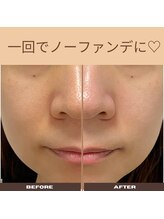 ミサズ スキンケア(misa's skin care)/一回でノーファンデOKに♪