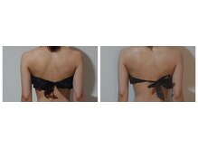 セラフ(Seraph)/ブライダル