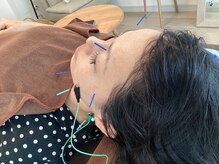 ハリファ鍼灸院 横浜関内院(HariFa鍼灸院)/美容施術