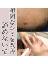 エステティック エイチアンドビー 大和店(H&B)/シミケア　フェイシャル