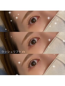 ベルナ(beluna)/ラッシュリフト