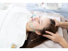 キヅキ鍼灸整体スタジオ(KIZUKI鍼灸整体スタジオ)/しわ/たるみ/頭スッキリ