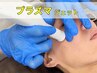 【シミ撲滅コース★リピート】光3500ショットまたはプラズマジェット￥16000