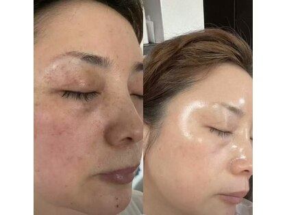 BBC 田園調布の写真