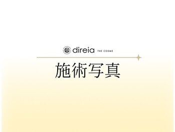 ディレイア ザ コスメ 有楽町マルイ店(direia the cosme)/施術内容をご紹介