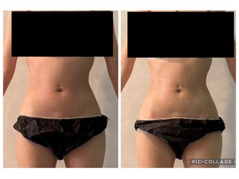 エクラ(Eclat)/Eclatの痩身★BeforeAfter9