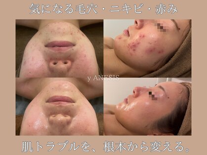 サロンワイアネシス(Salon y ANESIS)の写真