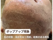 ダイヤ 名古屋中川区店(Daiya)/【ポップアップ現象】結果の差