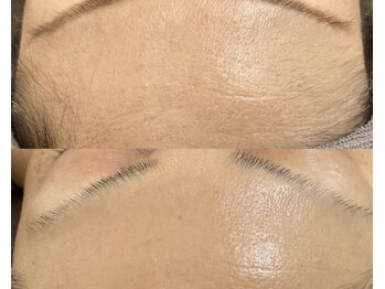 ルア(LUA)の写真/シェービングはもちろん、自分に合った肌ケアでくすみのない透明感のある素肌に◎