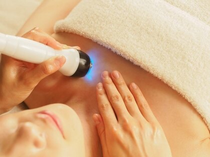 アルバ(Alba)の写真