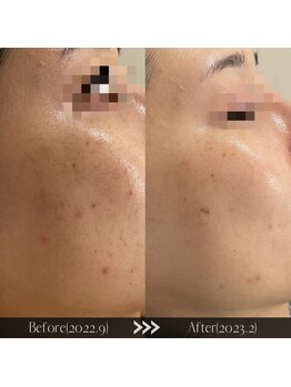 ラ クレール ビューティーサロン(LA CLAIR)/お客様BeforeAfter