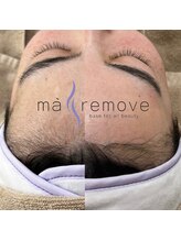 シック(Chic)/マリムーブフェイシャルワックス