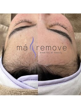 シック(Chic)/マリムーブフェイシャルワックス