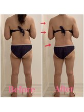 スペチアーレ 夙川/薄着になる前に解決