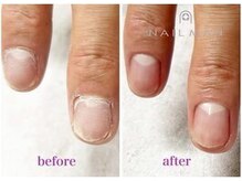 ネイルマン 新宿店(Nail Man)の雰囲気（驚きのBefore＆After!爪の悩みを改善!(メンズケア/メンズネイル)）