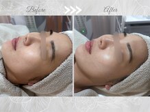 ＜素肌をキレイにする＞豊富な美肌育成メニューで素肌美人に。