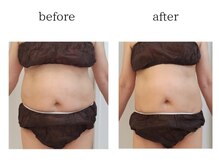 ユニクリア(Uni clear)/佐賀市ユニクリア痩身エステ