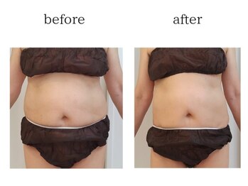 ユニクリア(Uni clear)/佐賀市ユニクリア痩身エステ