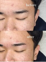 アイビー 長崎店(+i.b)/モテ眉パーフェクトコース